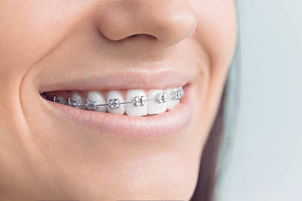 Best Full Mouth Reconstruction  in Buchanan, NY
